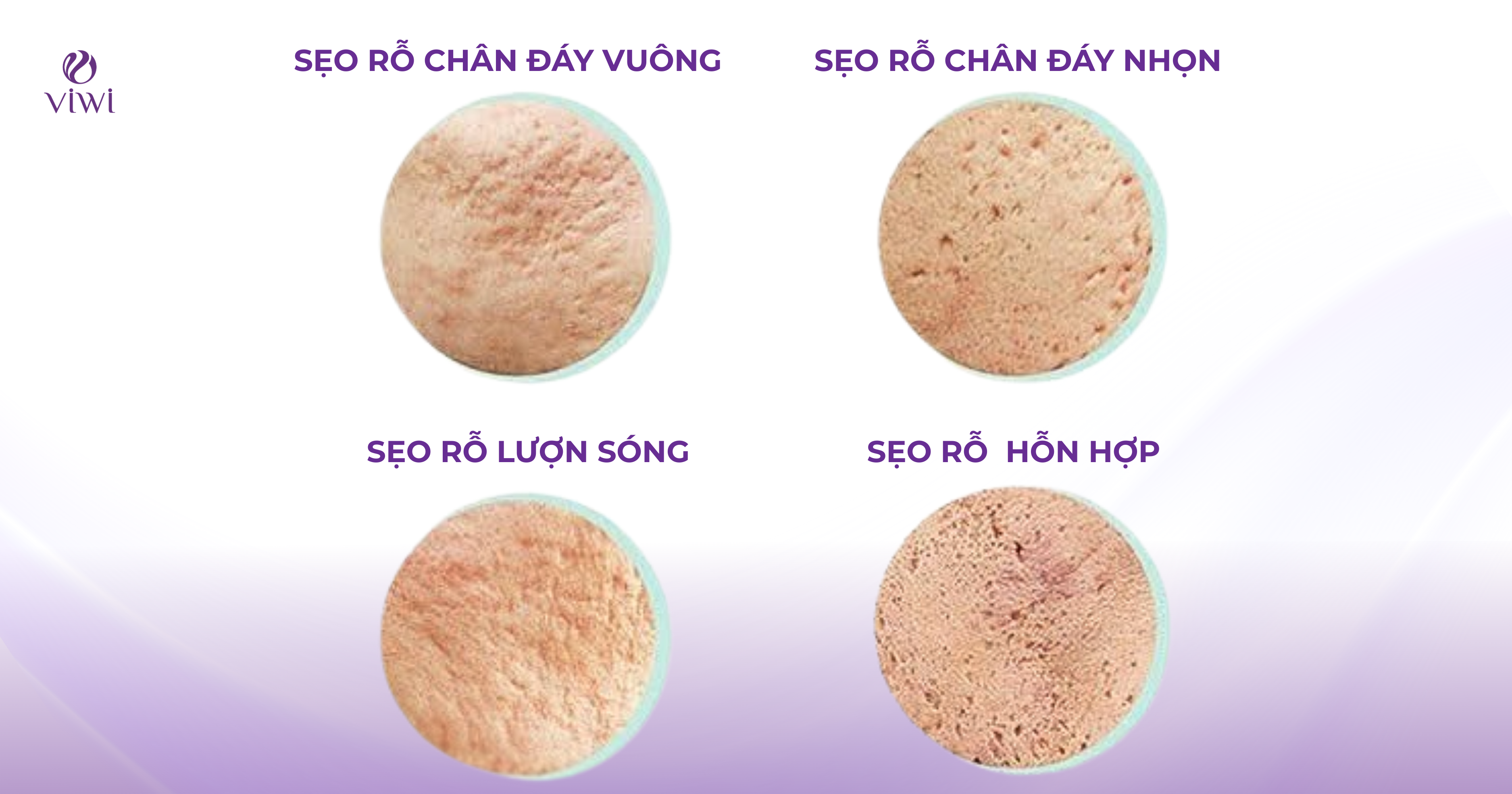 bóc tách đáy sẹo bằng khí 