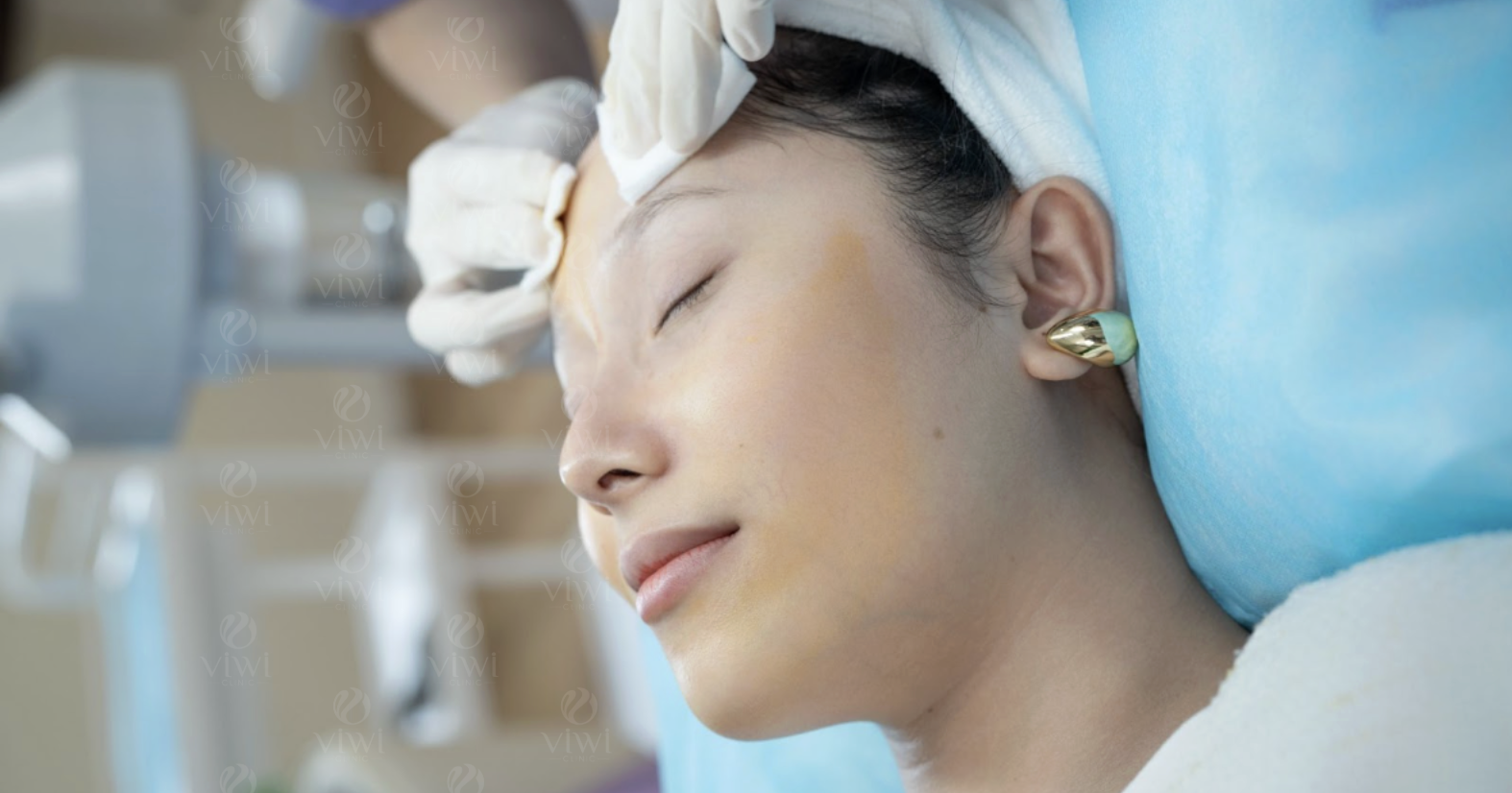 Lấy mụn chuyên sâu