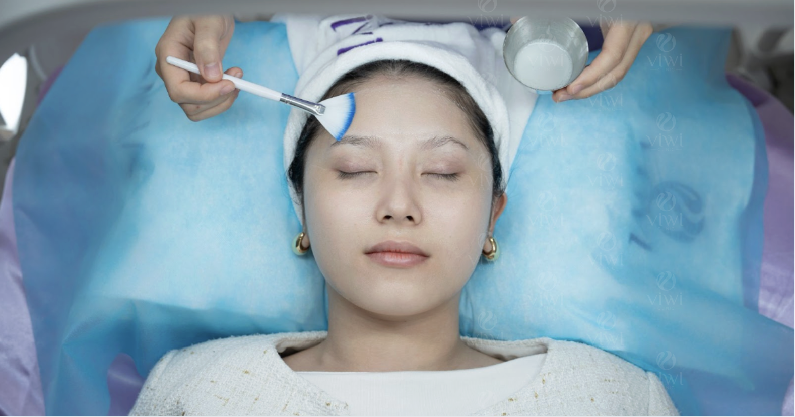 Lấy mụn chuyên sâu