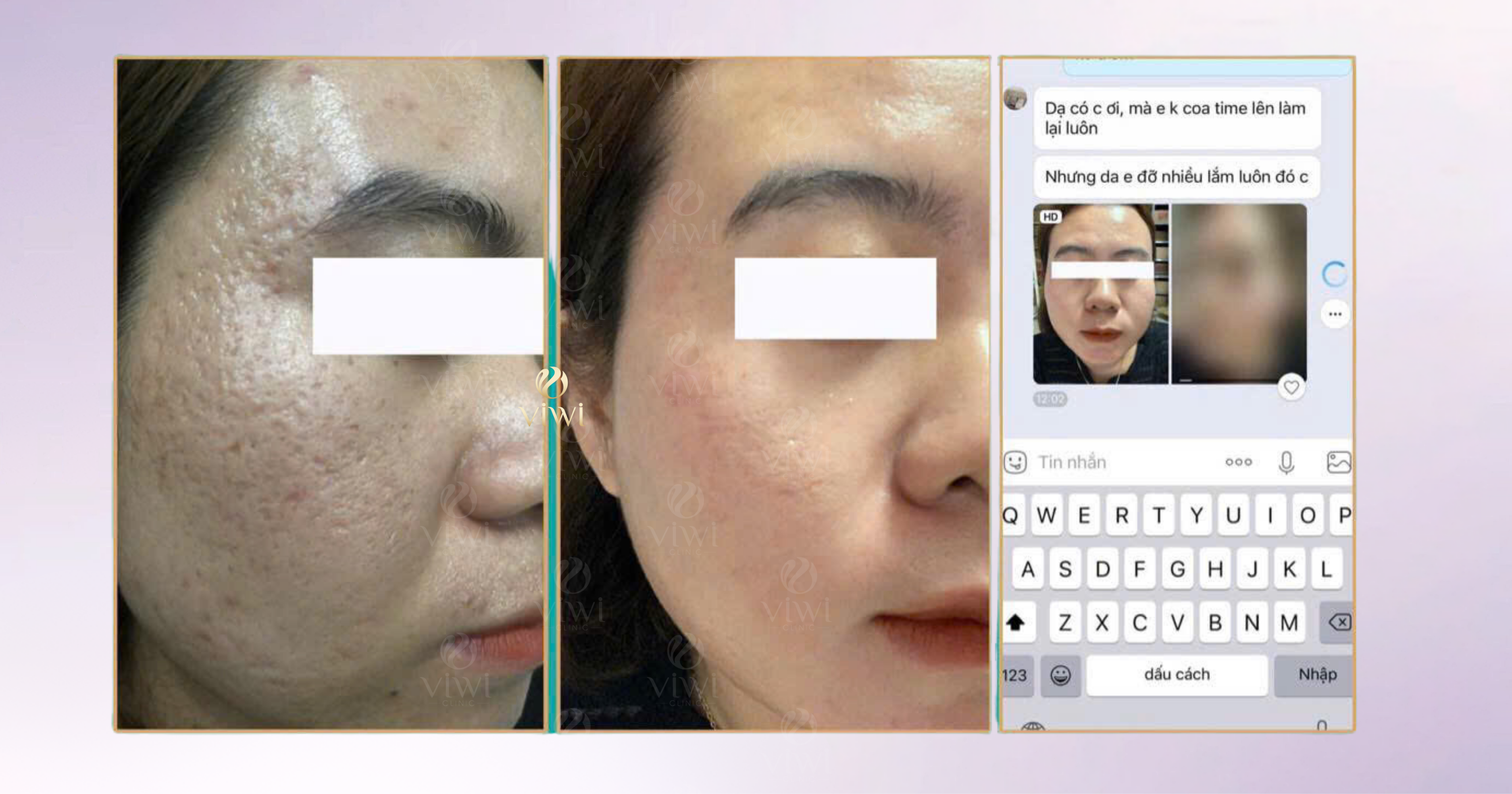 Phòng Khám Trị Sẹo Gò Vấp