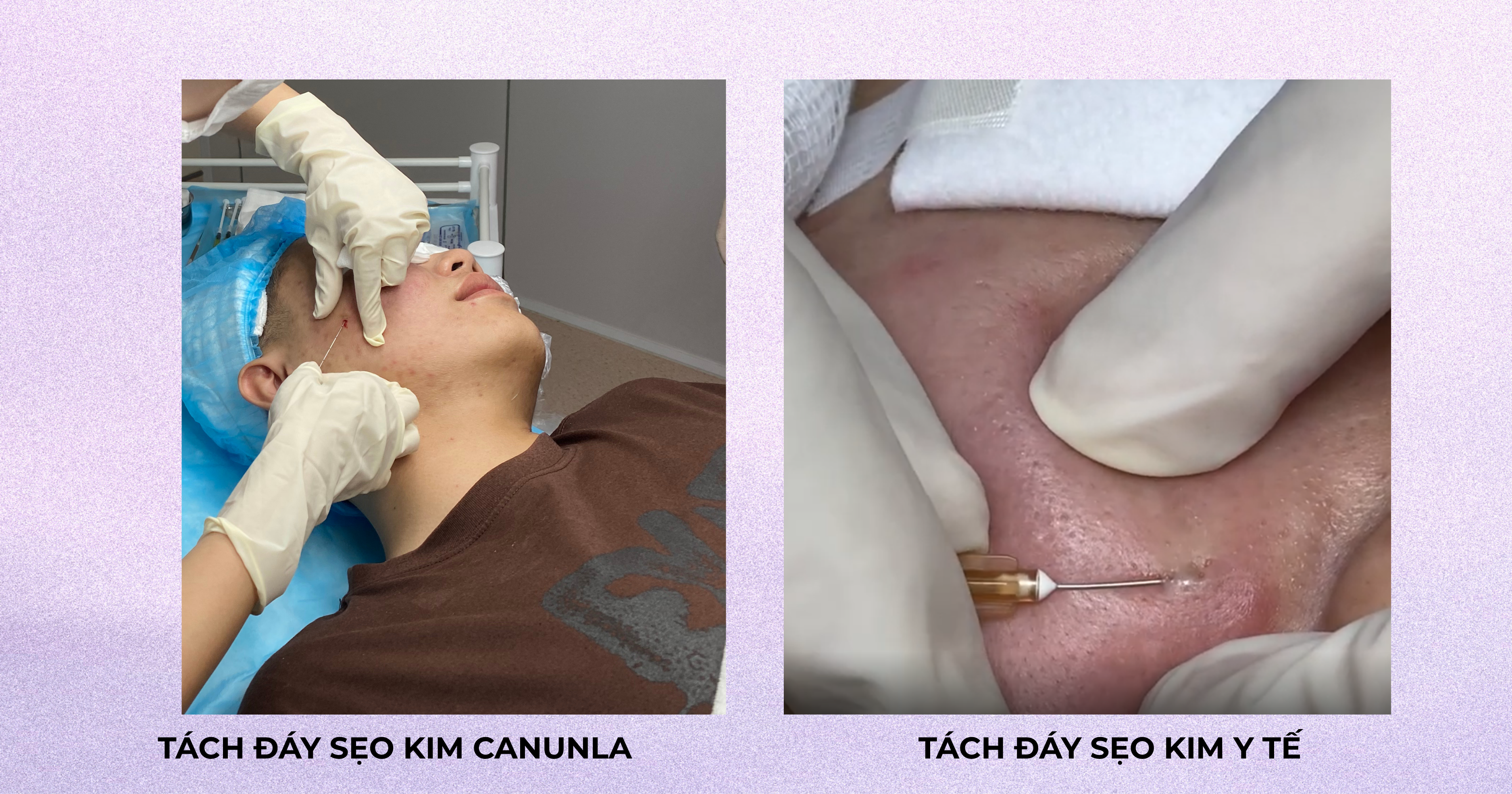 Phòng Khám Trị Sẹo Gò Vấp