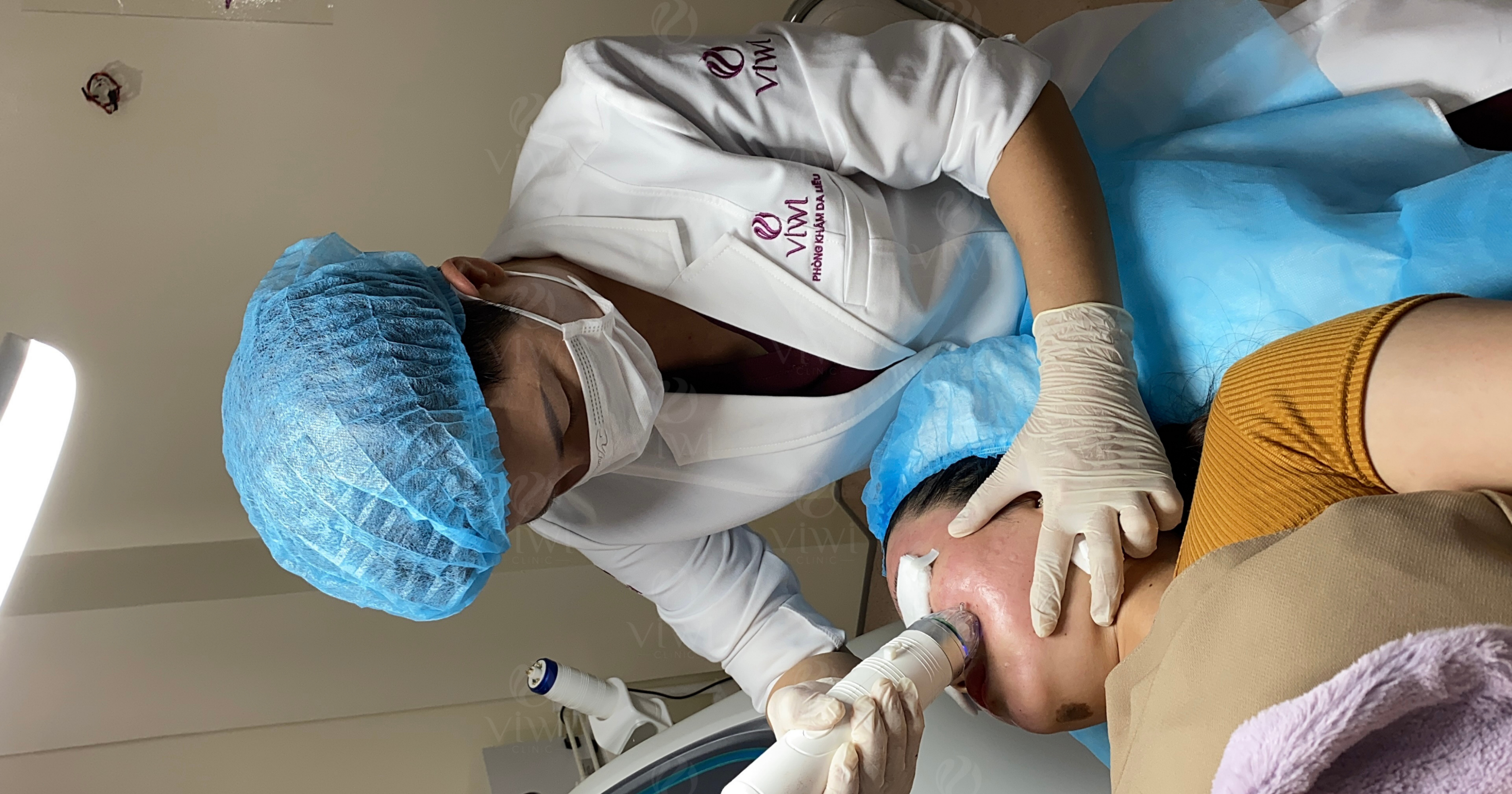 cách trị rỗ mặt