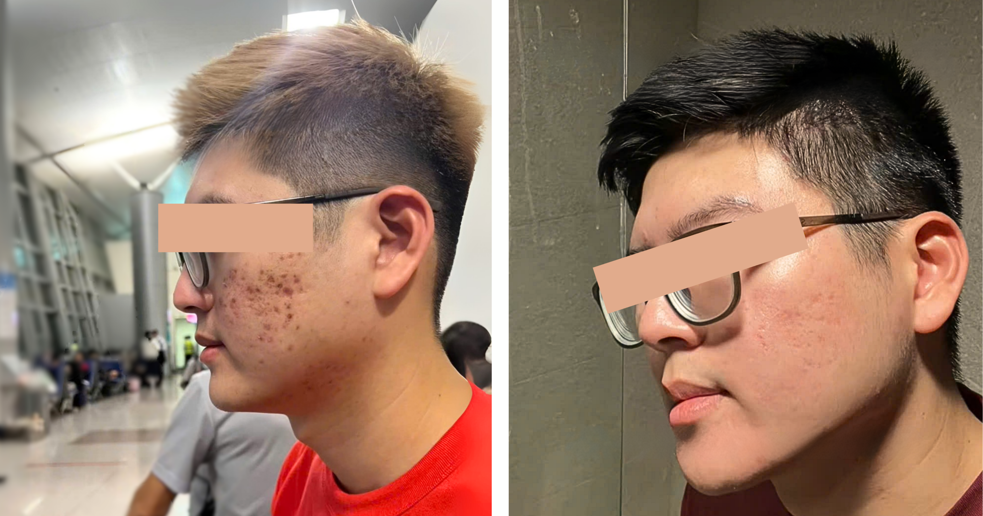 Phòng Khám Trị Sẹo Gò Vấp