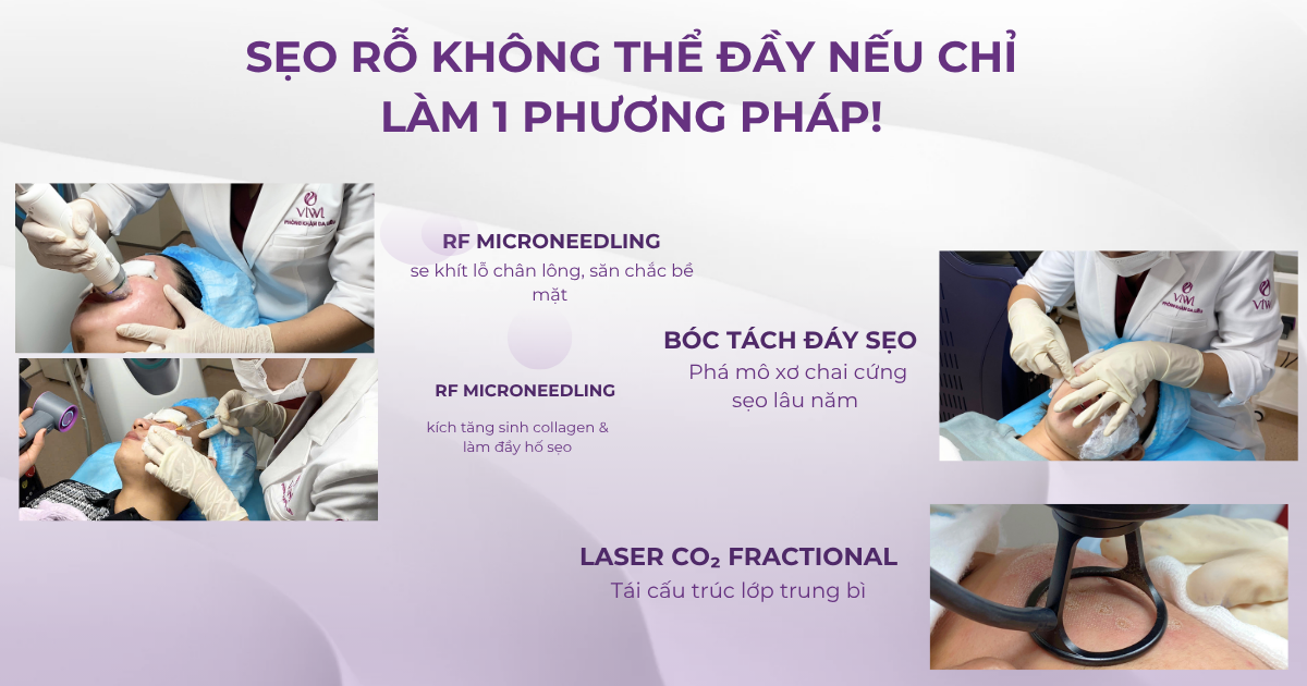 Phòng Khám Trị Sẹo Gò Vấp