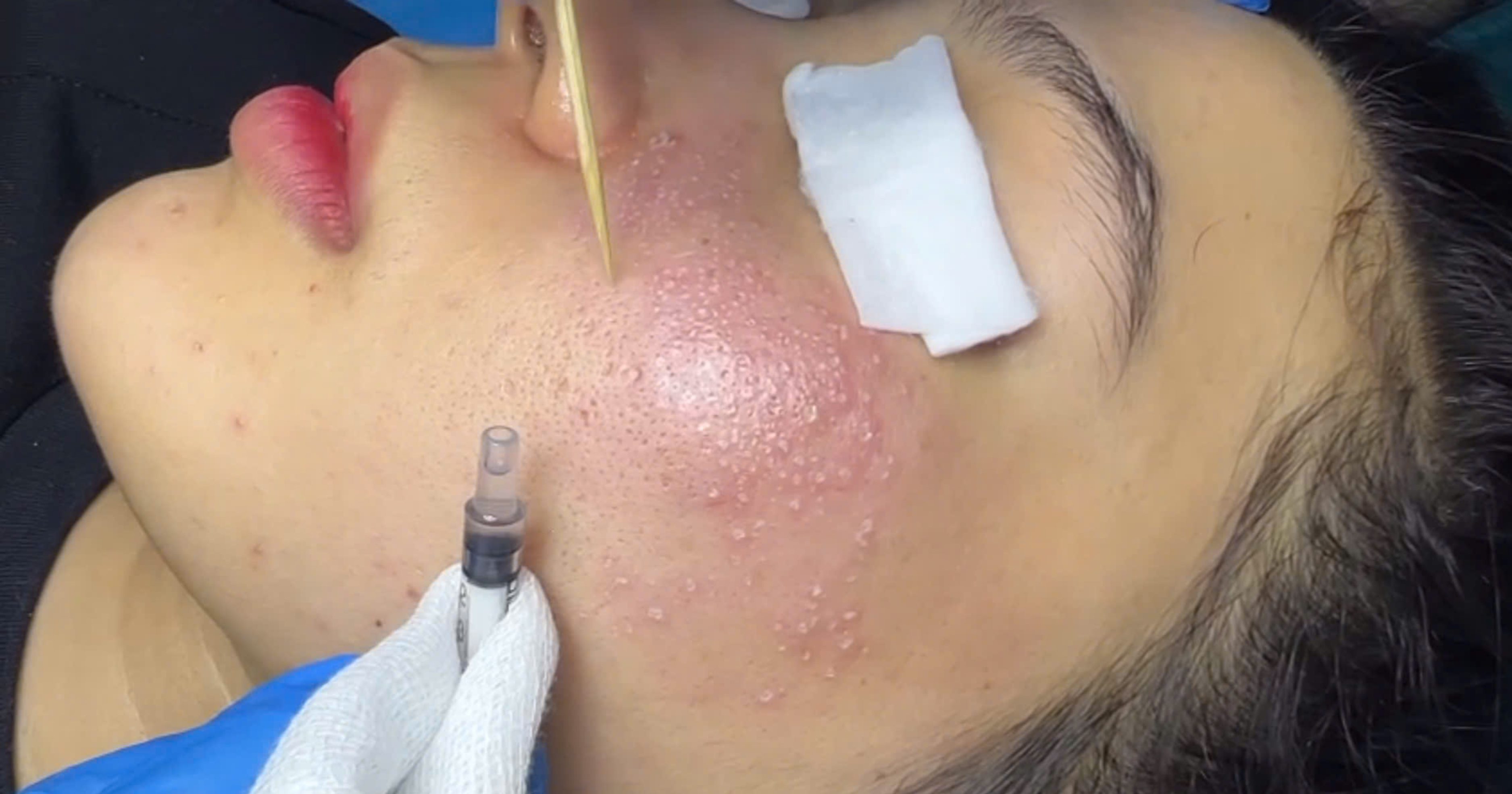 Phòng Khám Trị Sẹo Gò Vấp