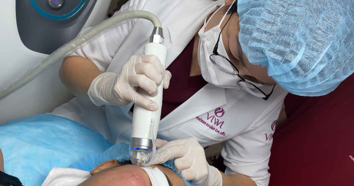 Sẹo rỗ lâu năm có trị hết hoàn toàn được không