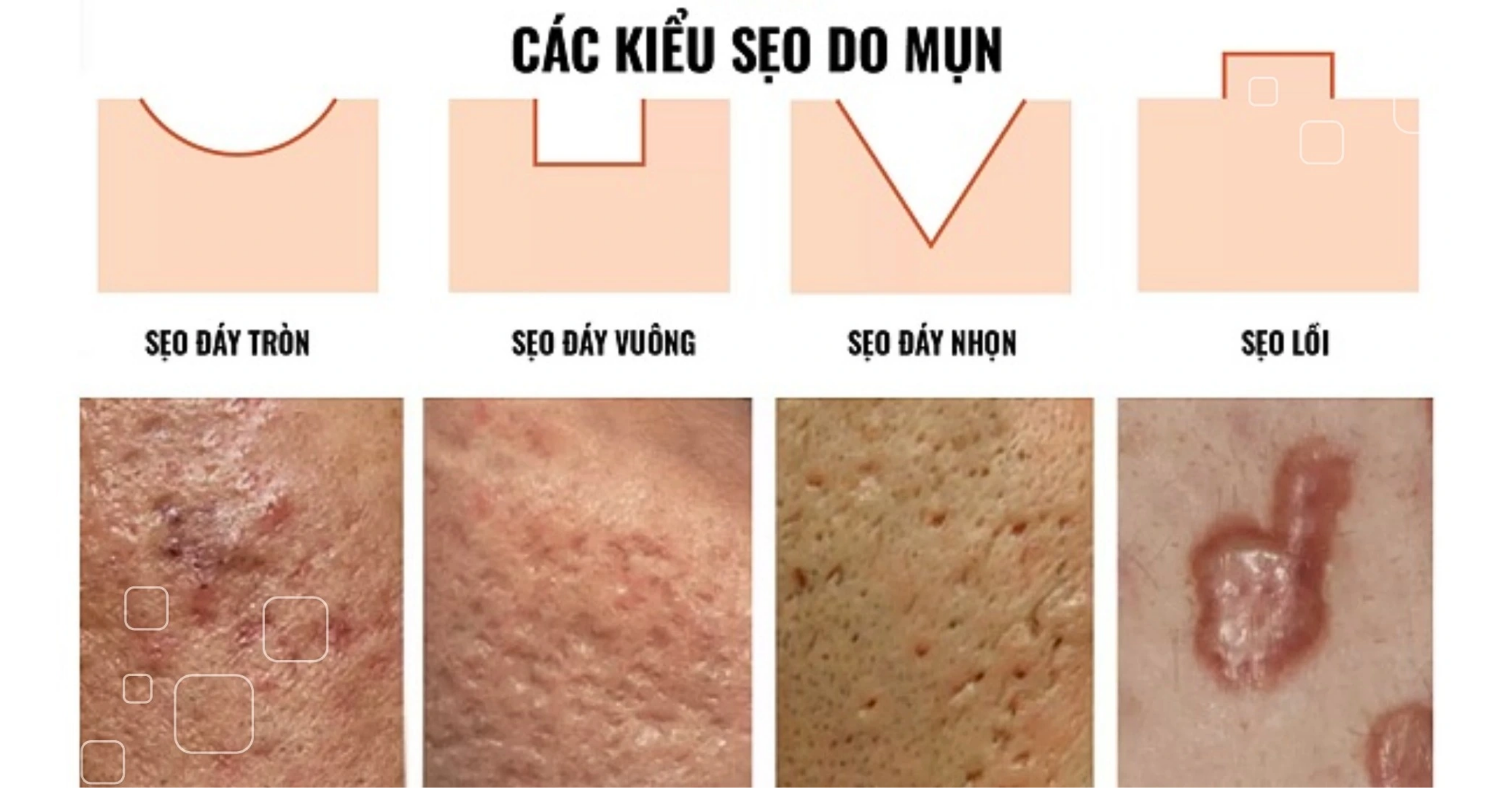 Địa chỉ trị sẹo