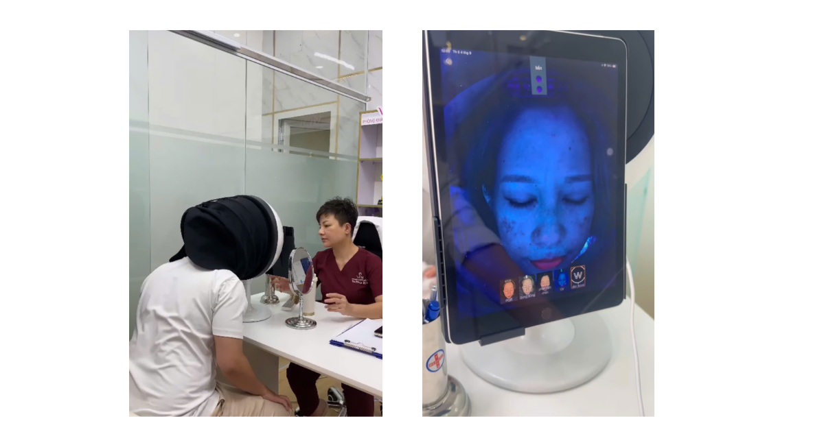 Địa chỉ trị sẹo uy tín hiệu quả ở HCM