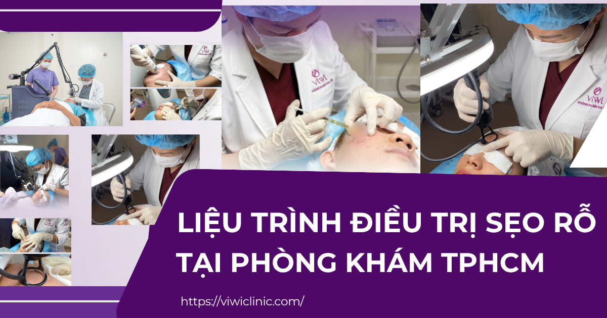 Liệu Trình Điều Trị Sẹo Rỗ Tại Phòng Khám TPHCM