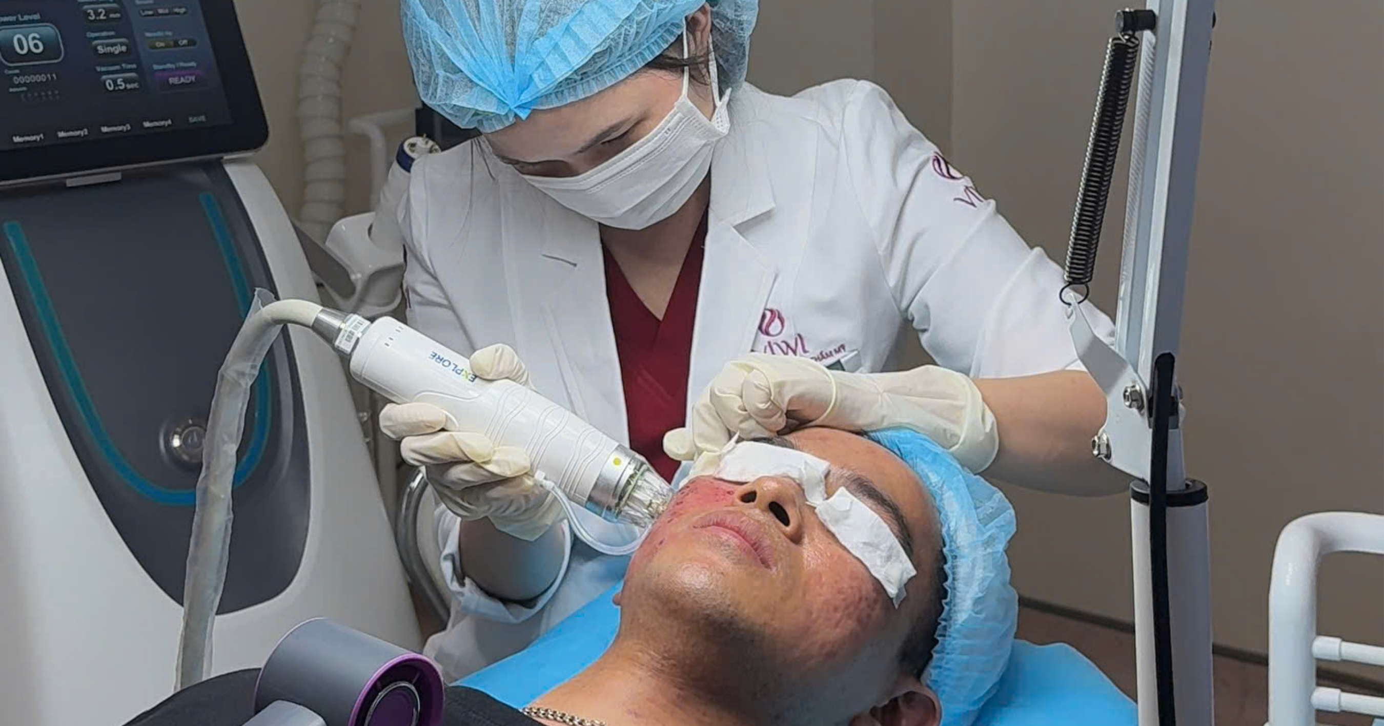 Sẹo rỗ có tự hết không