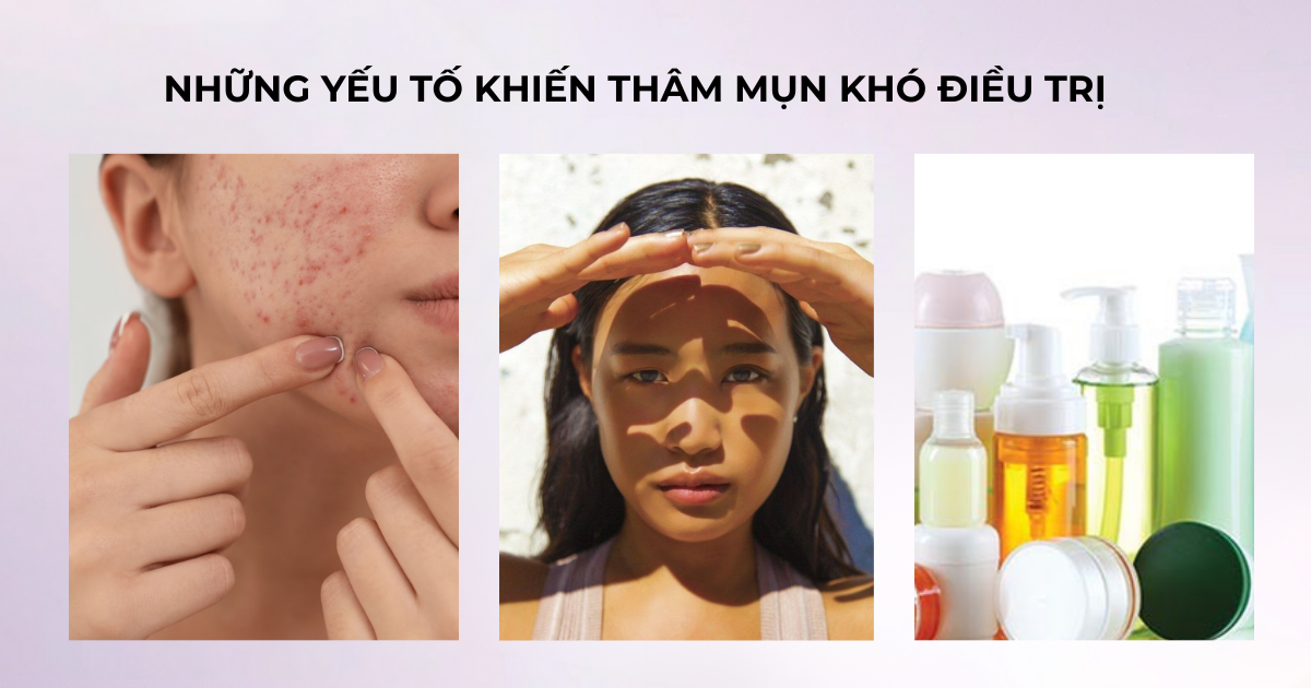 Trị thâm sau mụn nhanh cho da bị sạm lâu ngày